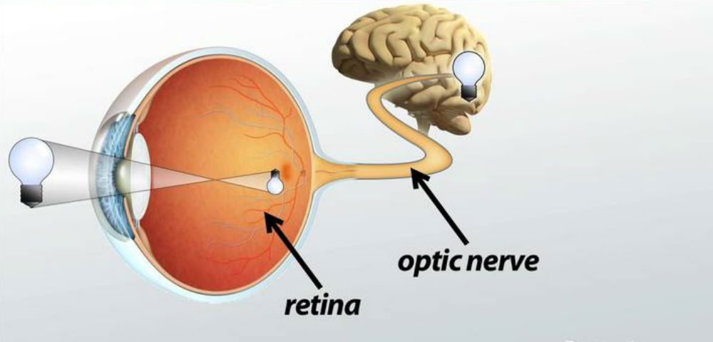 التهاب العصب البصري