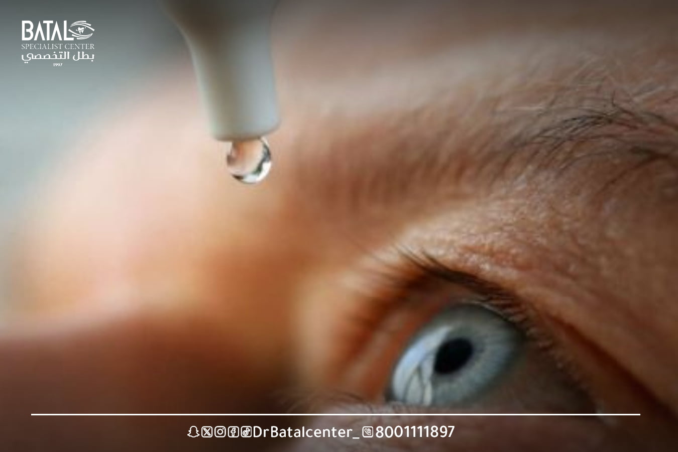 فحوصات ما قبل العملية في مجمع بطل التخصصي