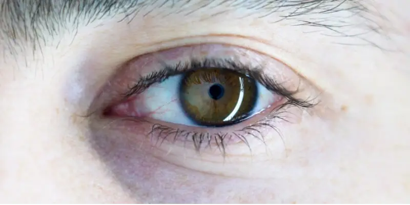 كيف تساعد القطرات على تحسين الوضوح البصري؟
