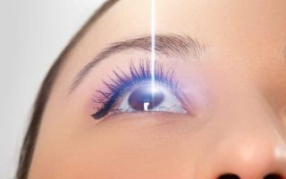 تكرار عملية الليزك