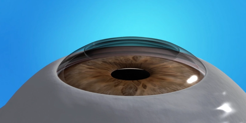 Endothelial Dysfunction / Low Endothelial Cell Count