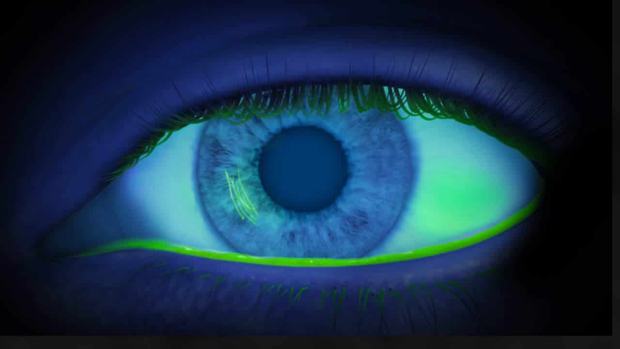 علاج خدش القرنية .. كيفية علاج خدش العين