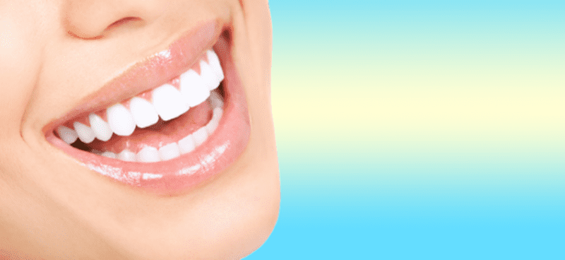 تكلفة تبييض الاسنان بالليزر وفوائده