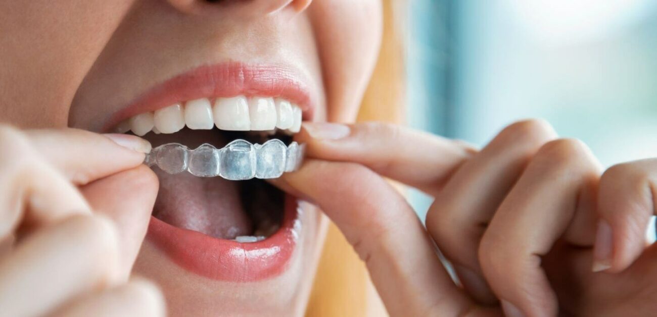 اصلاح مشاكل الاسنان