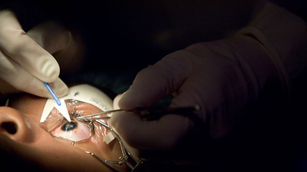 أهم الأسباب للتفكير في الليزك