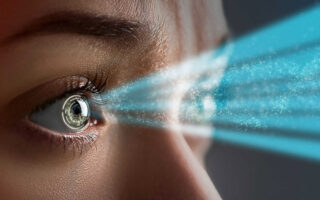 مسح عدسة العين بالليزر