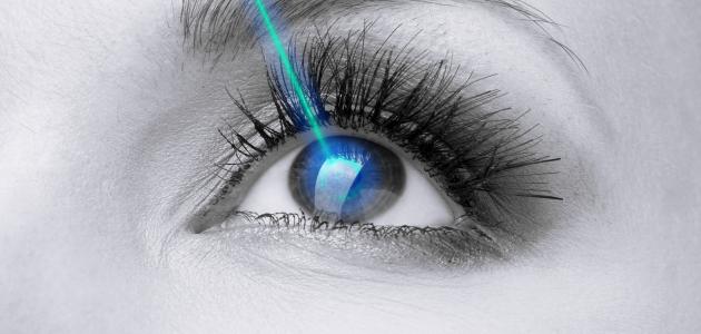 مخاطر عملية الليزر للعيون