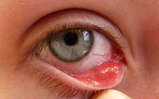 كيس دهني بالعين