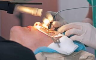 شروط عملية تصحيح النظر