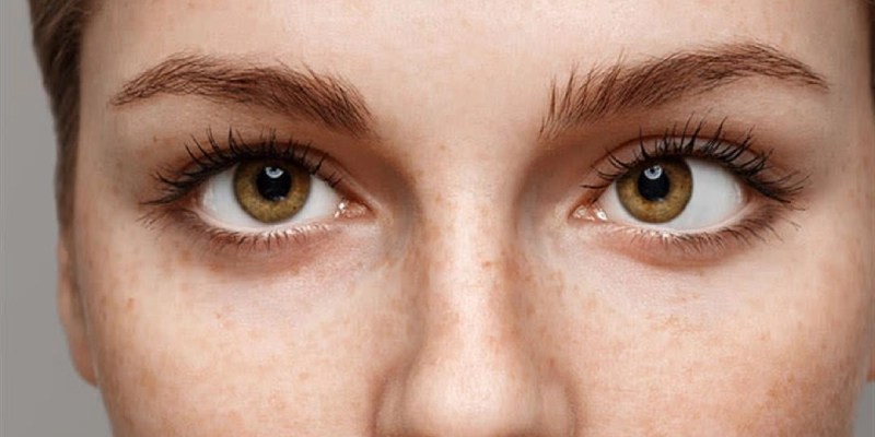 أسباب انحراف القرنية