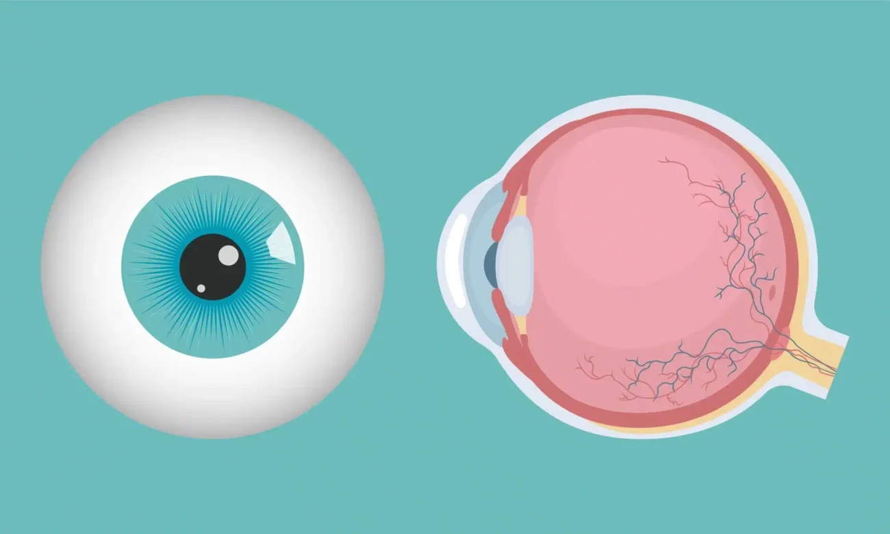 انحراف القرنية في العين