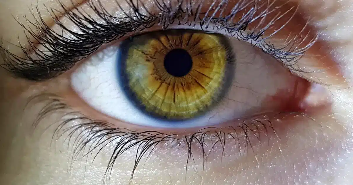 حقائق مهمة حول الجلوكوما