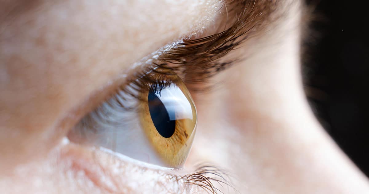 تصحيح النظر للقرنية المخروطية