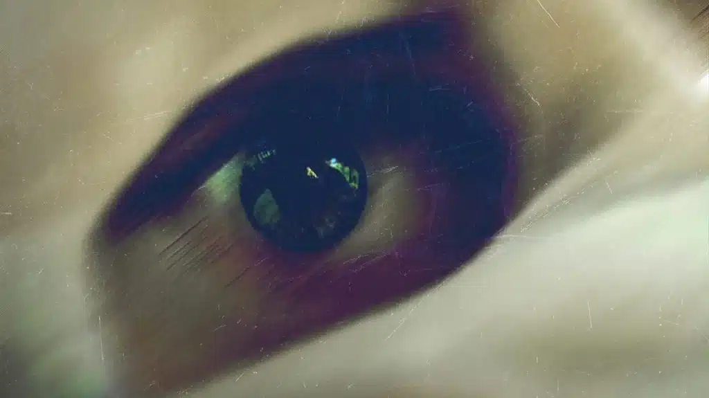 أسباب غشاوة العين وعلاجها