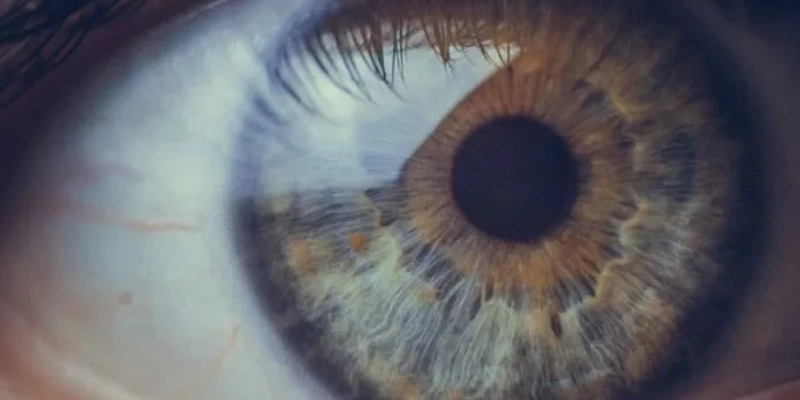 Corneal Thickness Measurement (Pachymetry)