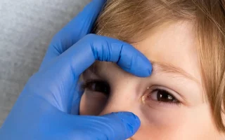 احمرار العين عند الأطفال من الأمور التي يسعى الآباء والأمهات للتعرف عليها،