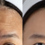 صور توضيحية لنتائج العملية قبل وبعد