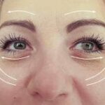 صور توضيحية لنتائج العملية قبل وبعد