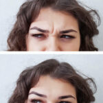 صور توضيحية لنتائج العملية قبل وبعد