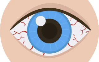 انسداد القناة الدمعية