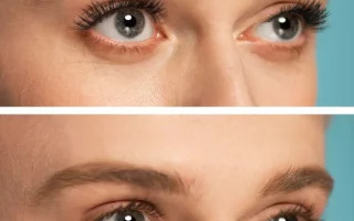 رفع الحاجب قبل وبعد: توقعات واقعية