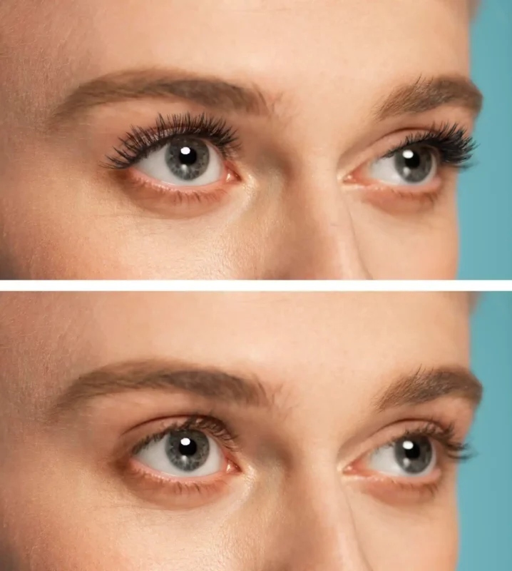 رفع الحاجب قبل وبعد: توقعات واقعية