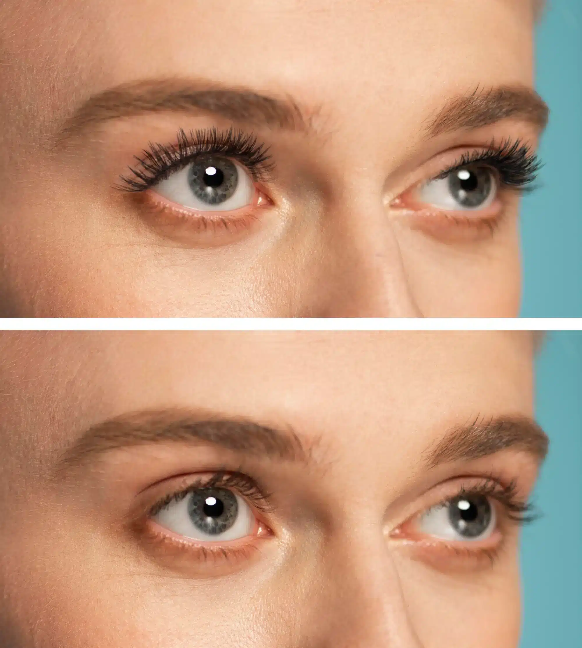 رفع الحاجب قبل وبعد: توقعات واقعية