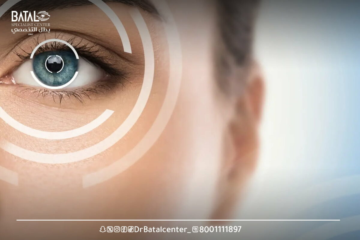 تكلفة عملية الليزك فى لندن بريطانيا