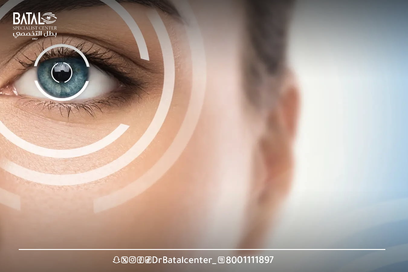 تكلفة عملية الليزك فى لندن بريطانيا