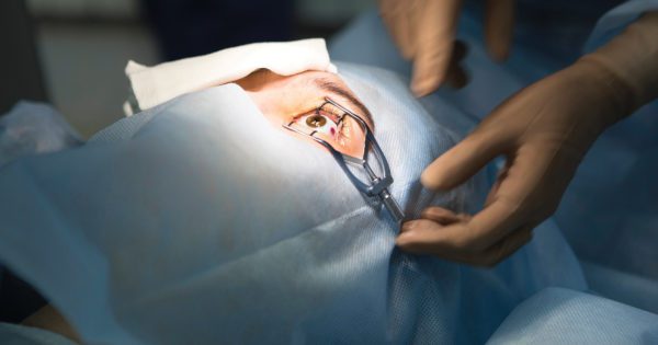 ما هي عملية الليزك؟