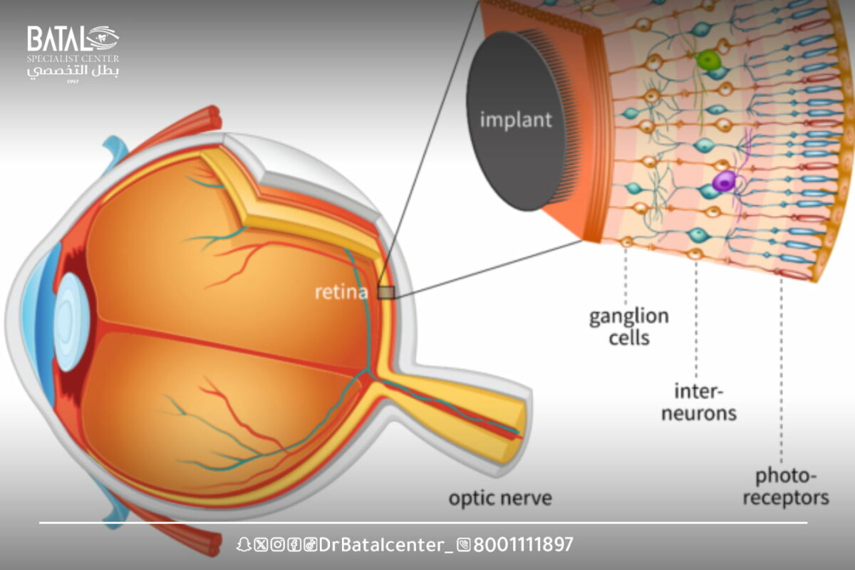 شبكية العين: التشريح, الوظيفة, العلاج