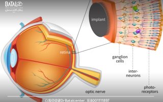 شبكية العين: التشريح, الوظيفة, العلاج