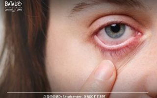 حساسية العين: الأسباب, والانواع, والعلاجات