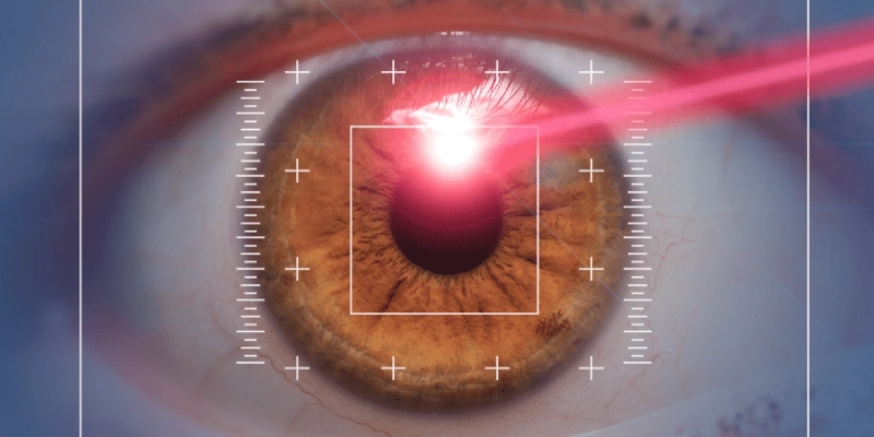 عملية تصحيح انحراف القرنية بالليزر