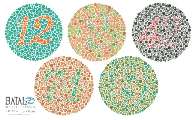 The most important tests for diagnosing color blindness