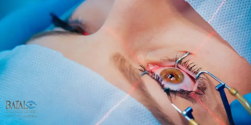 After cataract surgery and lens implantation