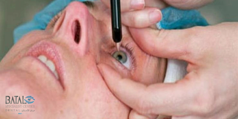 Retinal treatment options at Batal Specialized Complex