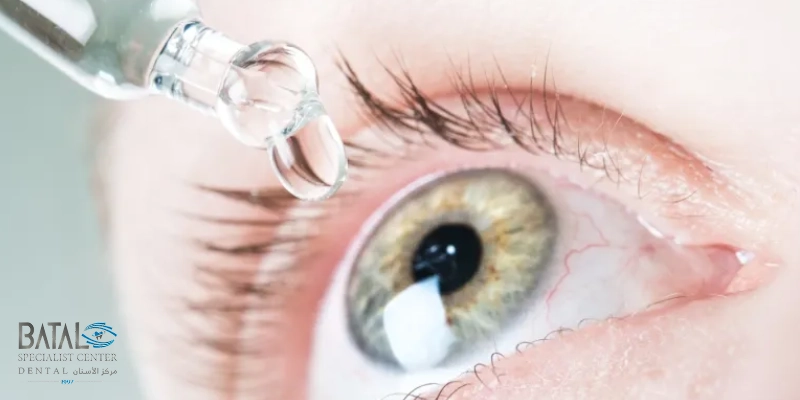 Causes of myopia in children