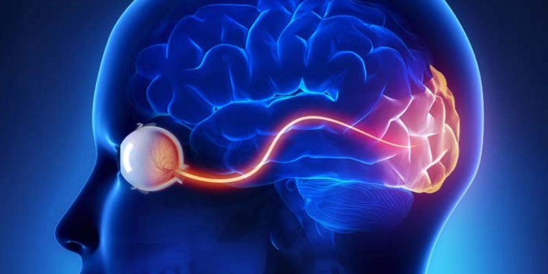 Causes of double vision related to nerves and brain (most serious)
