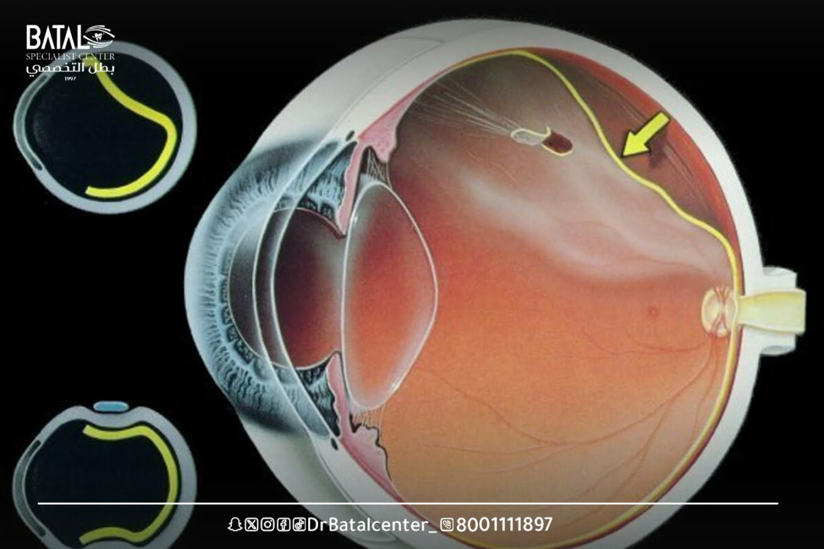 What is the retina and where is it located?