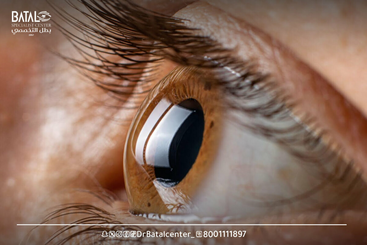 Common retinal diseases and their causes