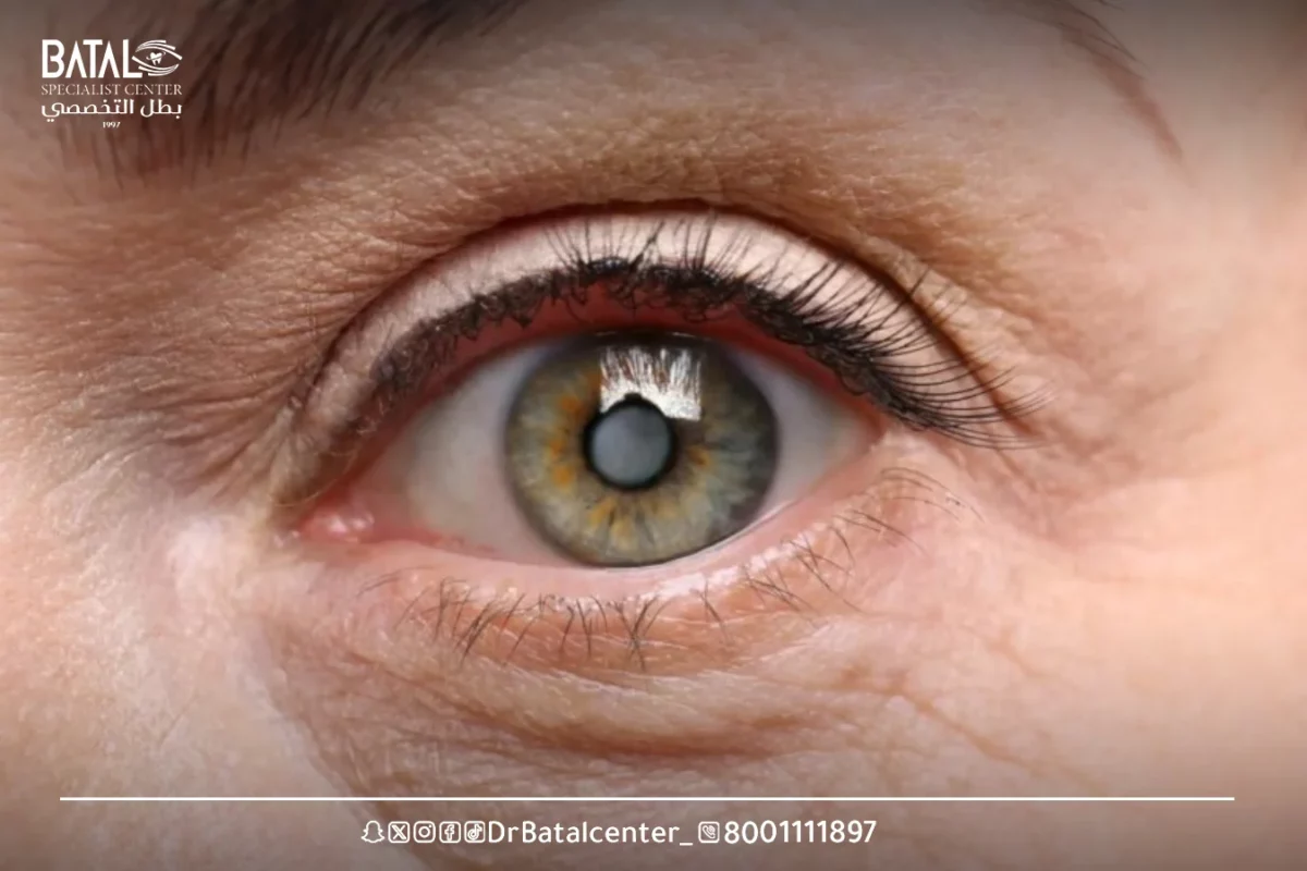 Factors that affect the duration of action of fundus drops