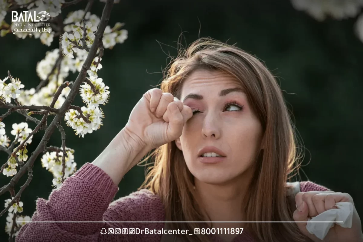 Symptoms of eye allergies and how to distinguish them from other diseases