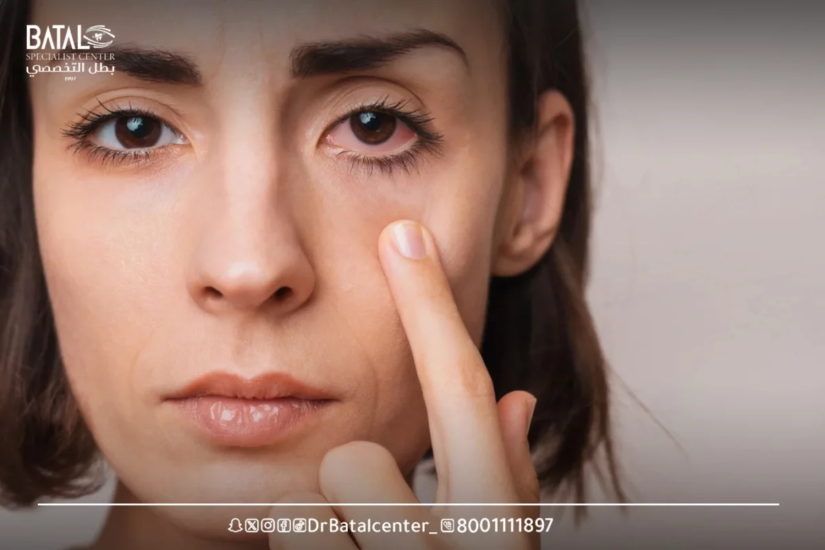 Tips from Batal Specialized Complex doctors to prevent eye allergies