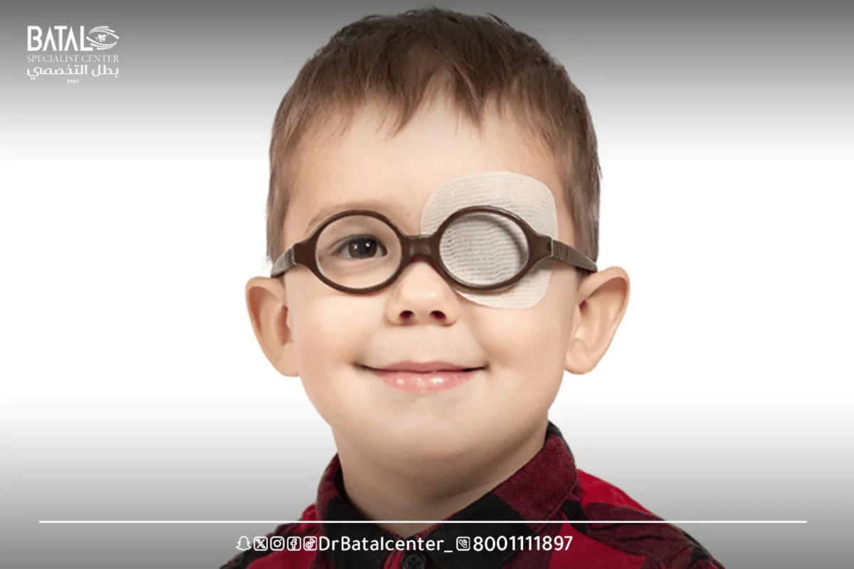 You may be interested in: Simple periocularism in children