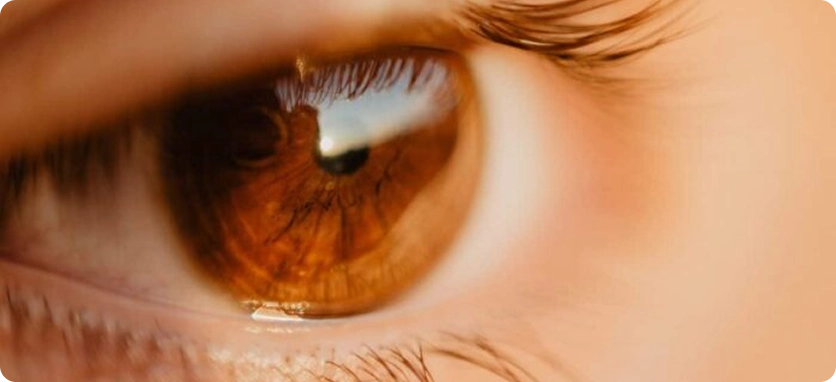 متى تحتاج إلى جراحة المياه البيضاء في العين؟