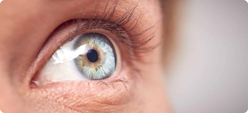 هل تتحول المياه البيضاء إلى زرقاء