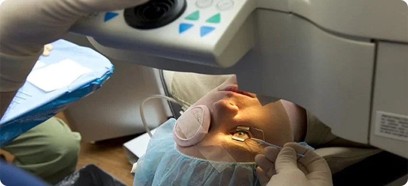 الجراحة المجهرية (جراحة تصفية المياه الزرقاء)