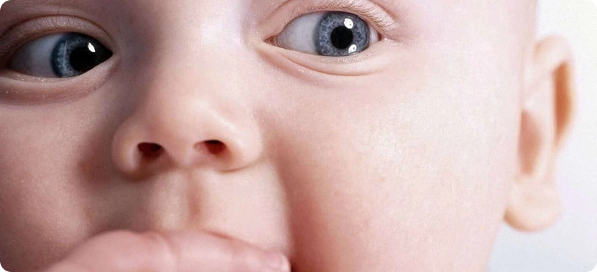 علاج وجراحة عيون الأطفال