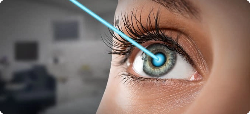 أسباب اللجوء إلى عملية الليزك